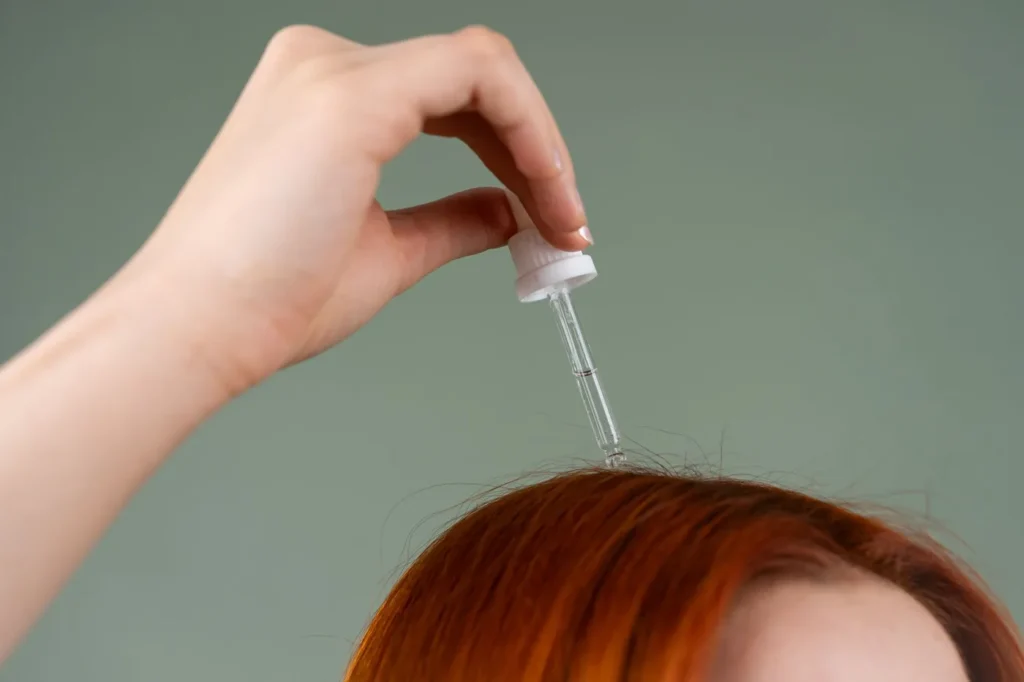 Chute de cheveux et greffe capillaire